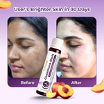 Glutathione Shots